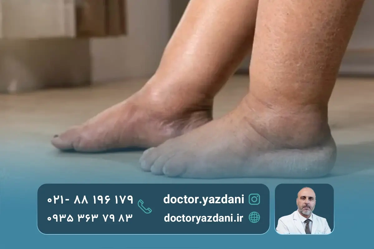 علائم صافی کف پا در بزرگسالی