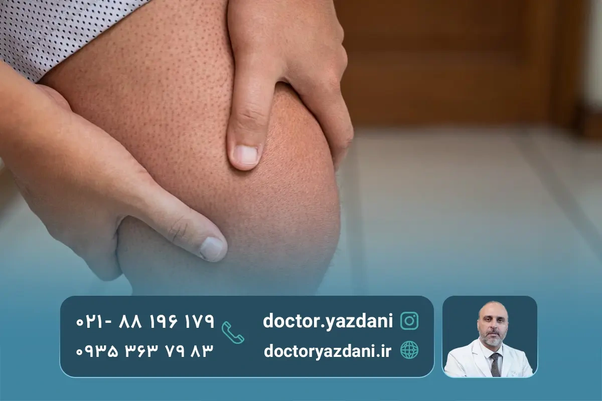 علائم پیچ خوردگی زانو