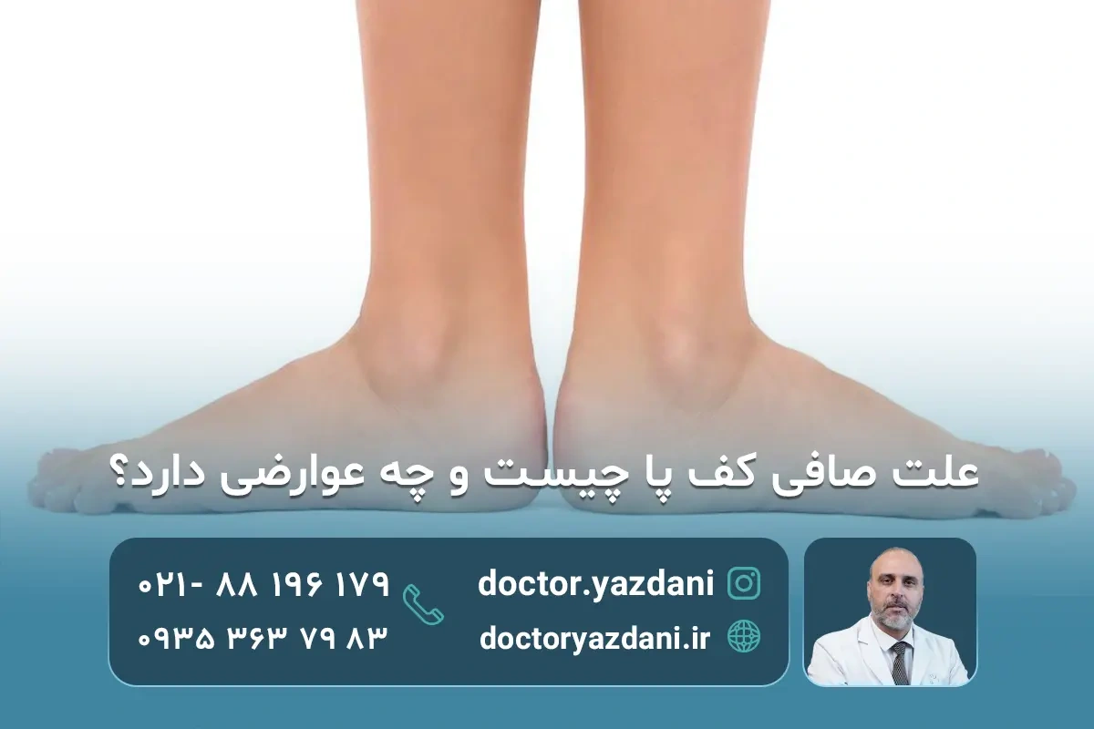 علت،تشخیص و درمان صافی کف پا در کودکان و بزرگسالان