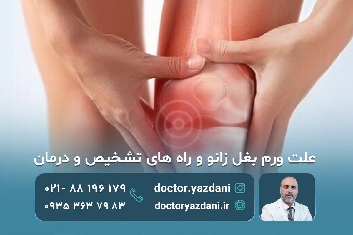 6 علت ورم بغل زانو و مؤثرترین درمان خانگی و پزشکی