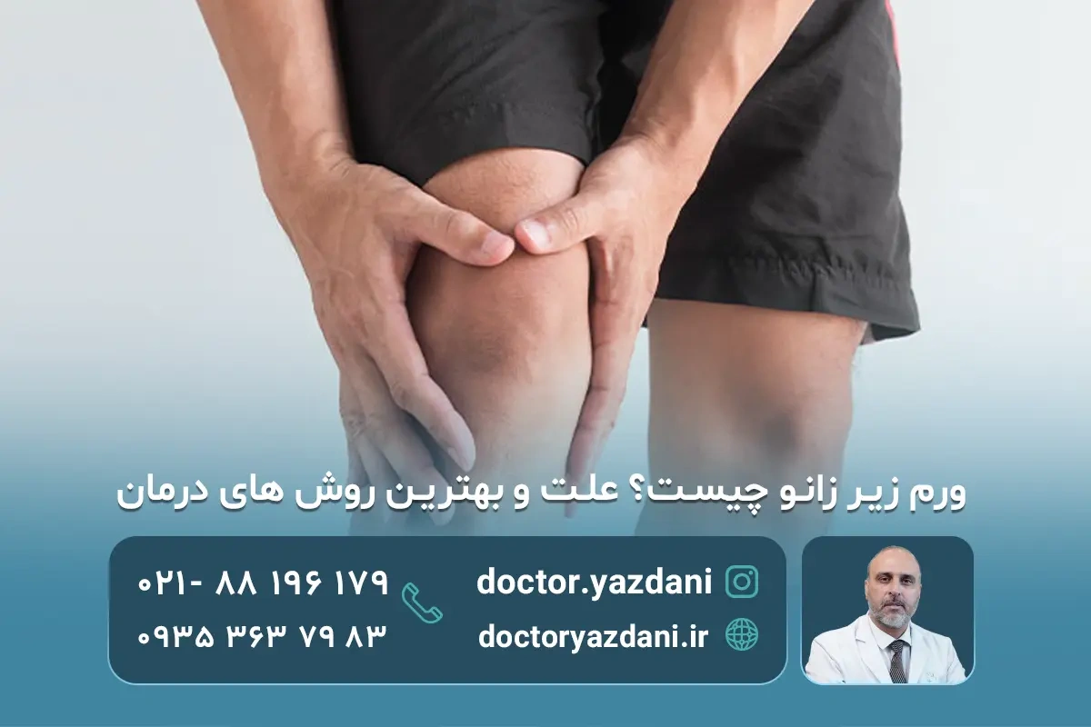 10 علت مهم ورم زیر زانو و بهترین راهکار های درمان