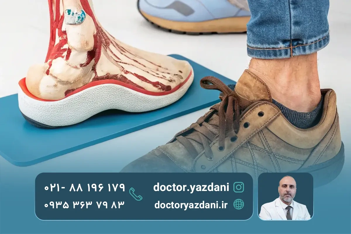 علت التهاب زانو یا (تاندونیت زانو) چیست؟