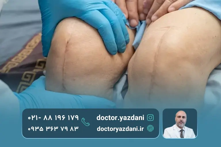 علت انجام جراحی