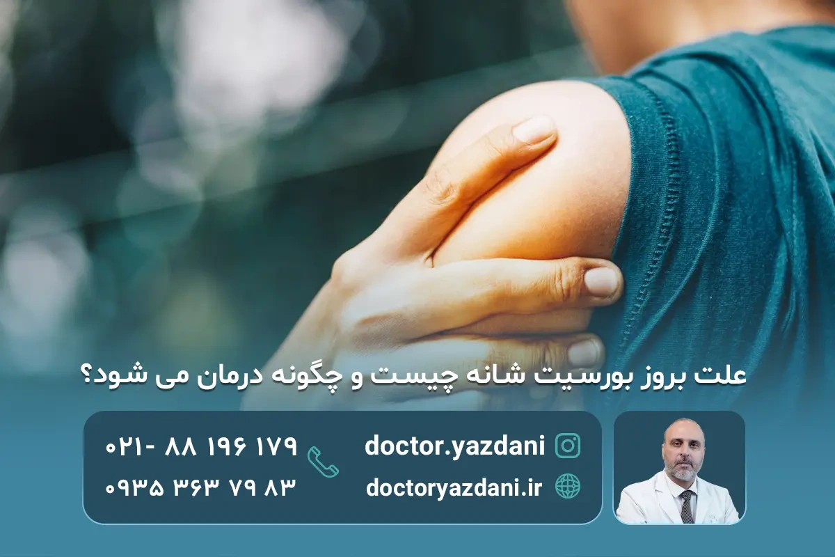بورسیت شانه؛ از علت و علائم تا درمان قطعی