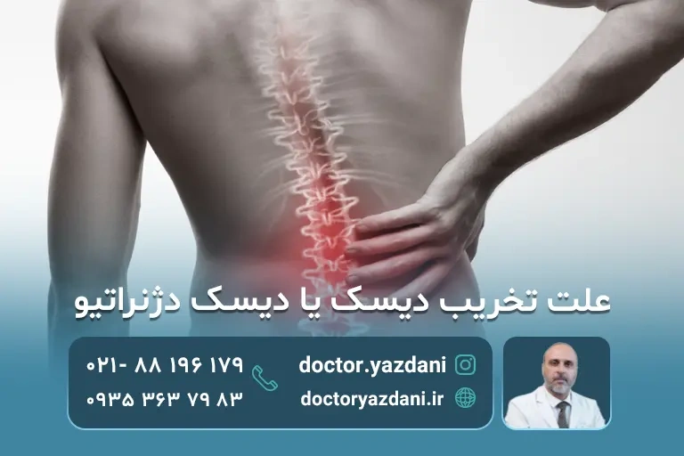 علت تخریب دیسک یا دیسک دژنراتیو و بهترین درمان بدون جراحی