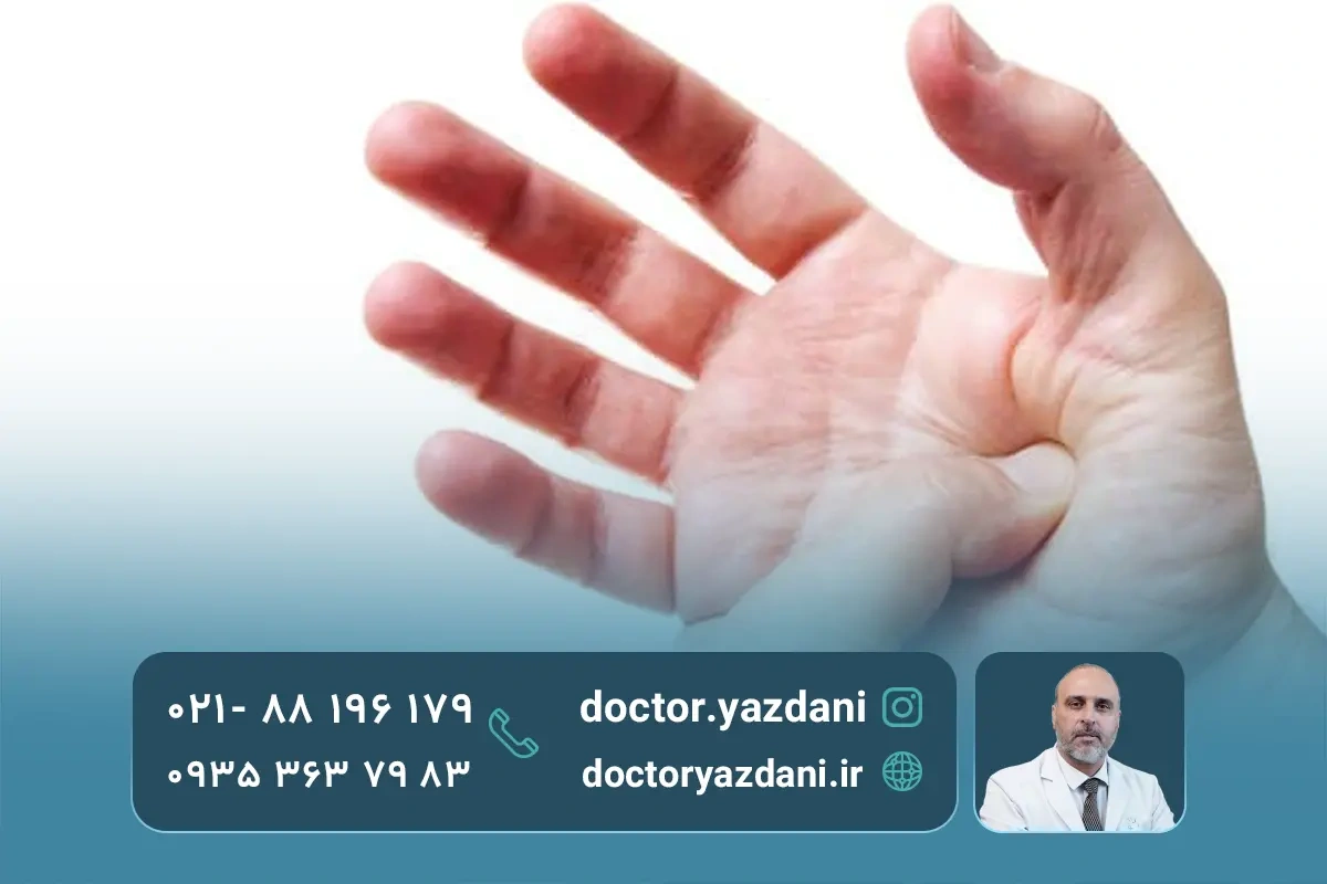 علت داغی کف دست راست