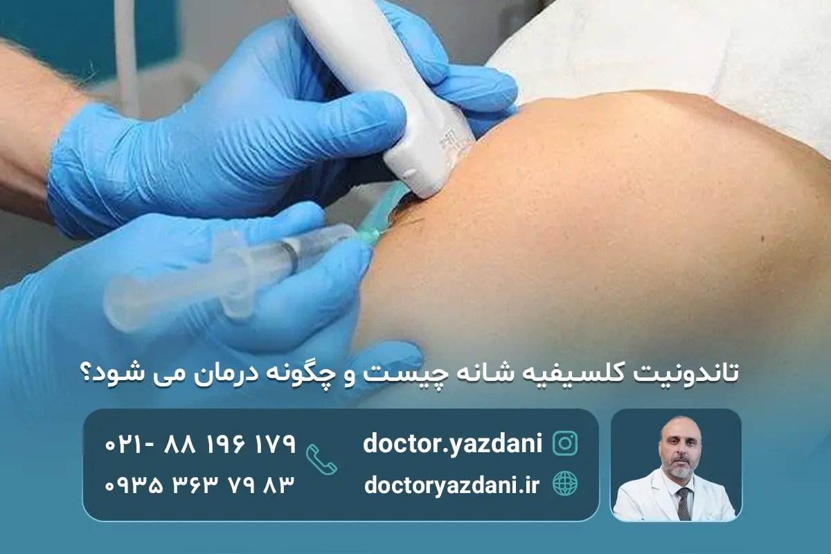 تاندونیت کلسیفیه شانه: علائم، علت‌ها و سریع‌ترین درمان