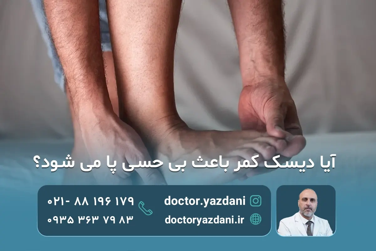 علت و درمان دیسک کمر و بی حسی پا