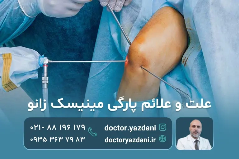 پارگی مینیسک زانو در حال درمان