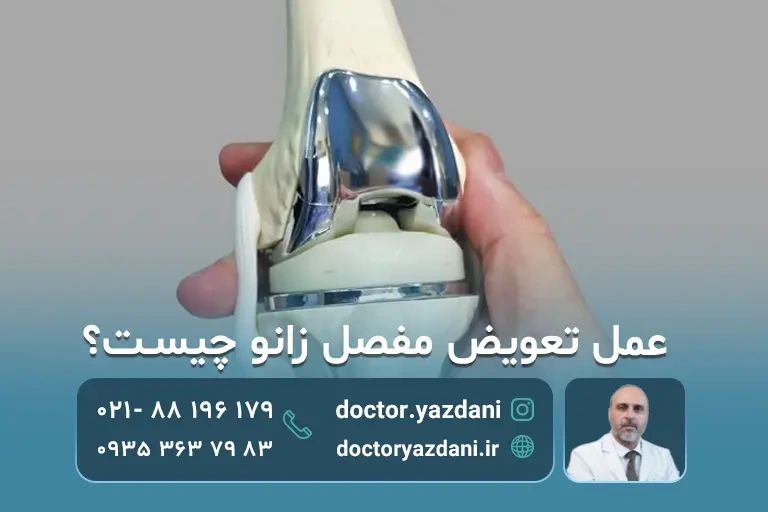 جراحی تعویض مفصل زانو