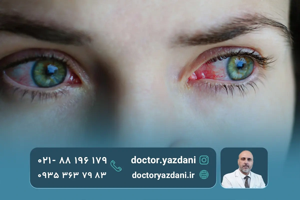 عوارض بیماری ام‌اس