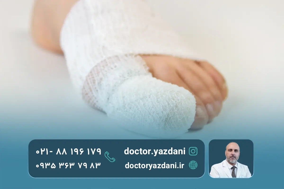 عوارض عمل فیوژن