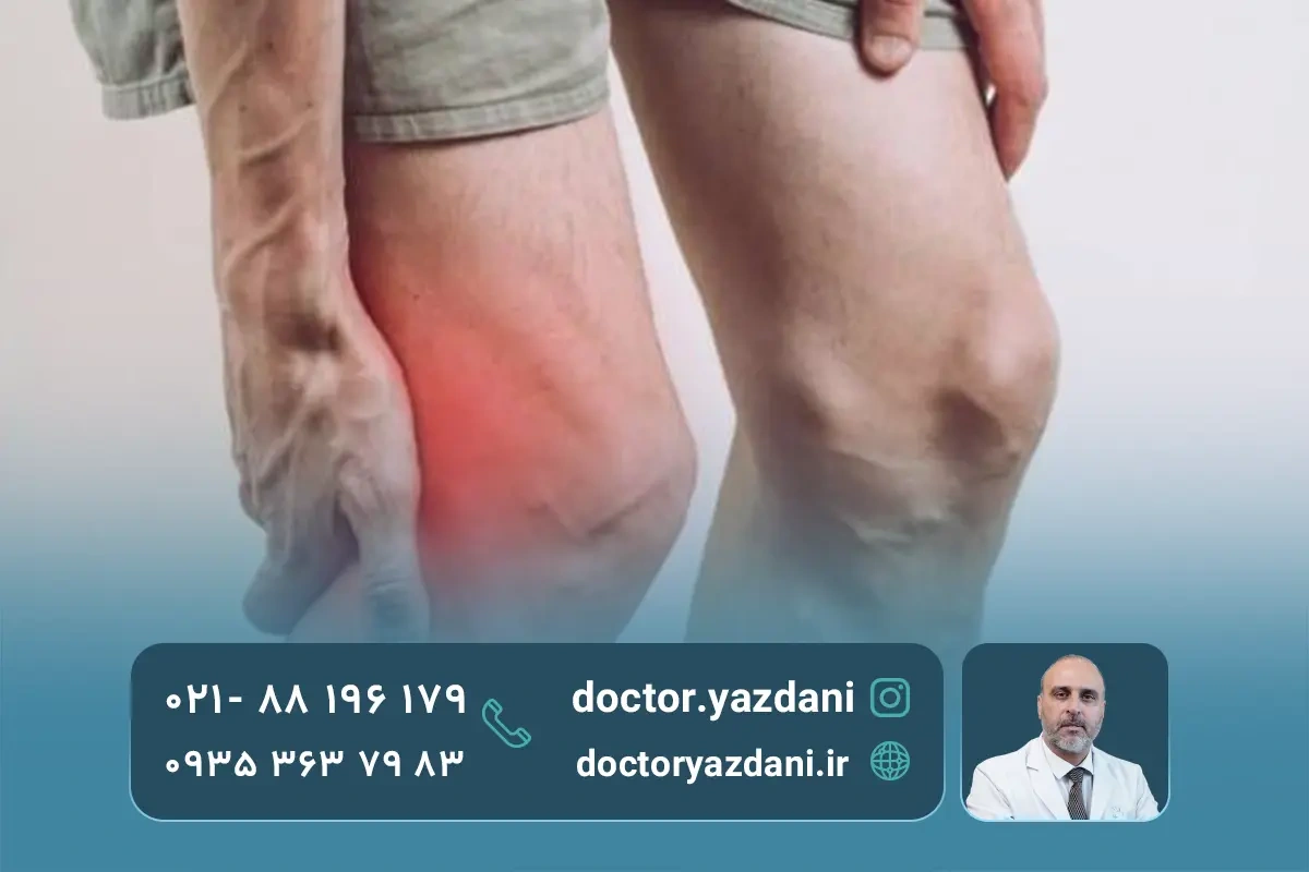 عوارض و محدودیت های درمان پارگی مینیسک زانو