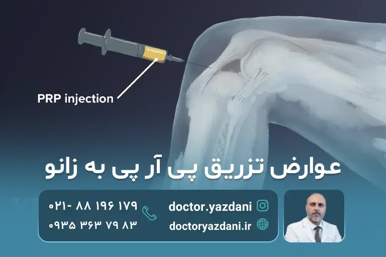 عوارض تزریق PRP به زانو