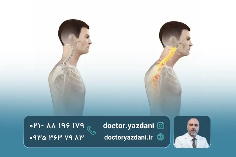 عکس آناتومی سر رو به جلو