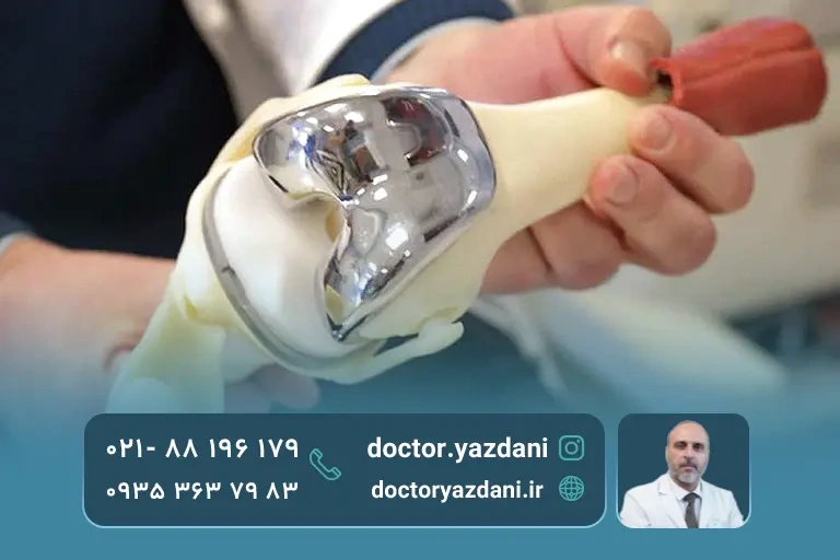 عکس پروتز زانو