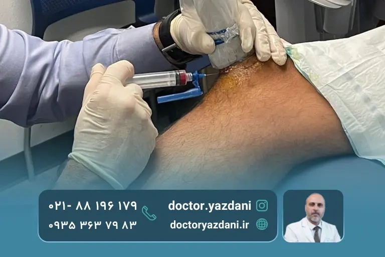 تصویر تزریق پی آر پی به زانو