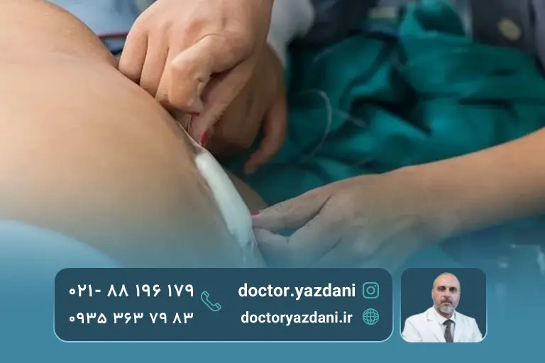 عکس پی آر پی به کمر