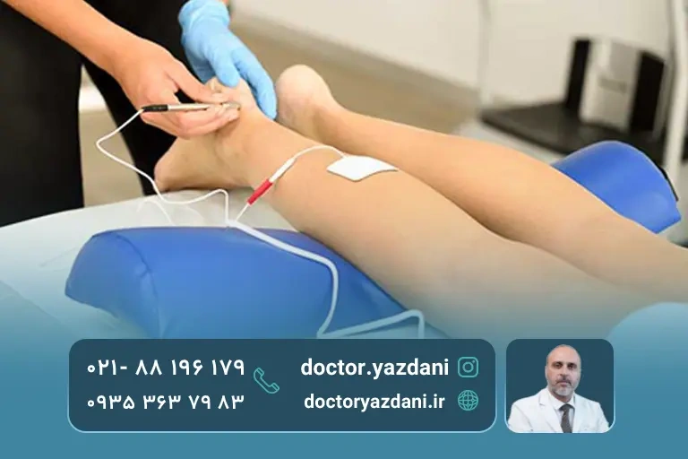 فیزیوتراپی سیاتیک