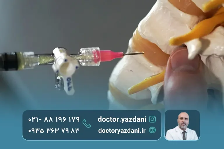 مراقبت بعد تزریق دیسکوژل به ستون فقرات