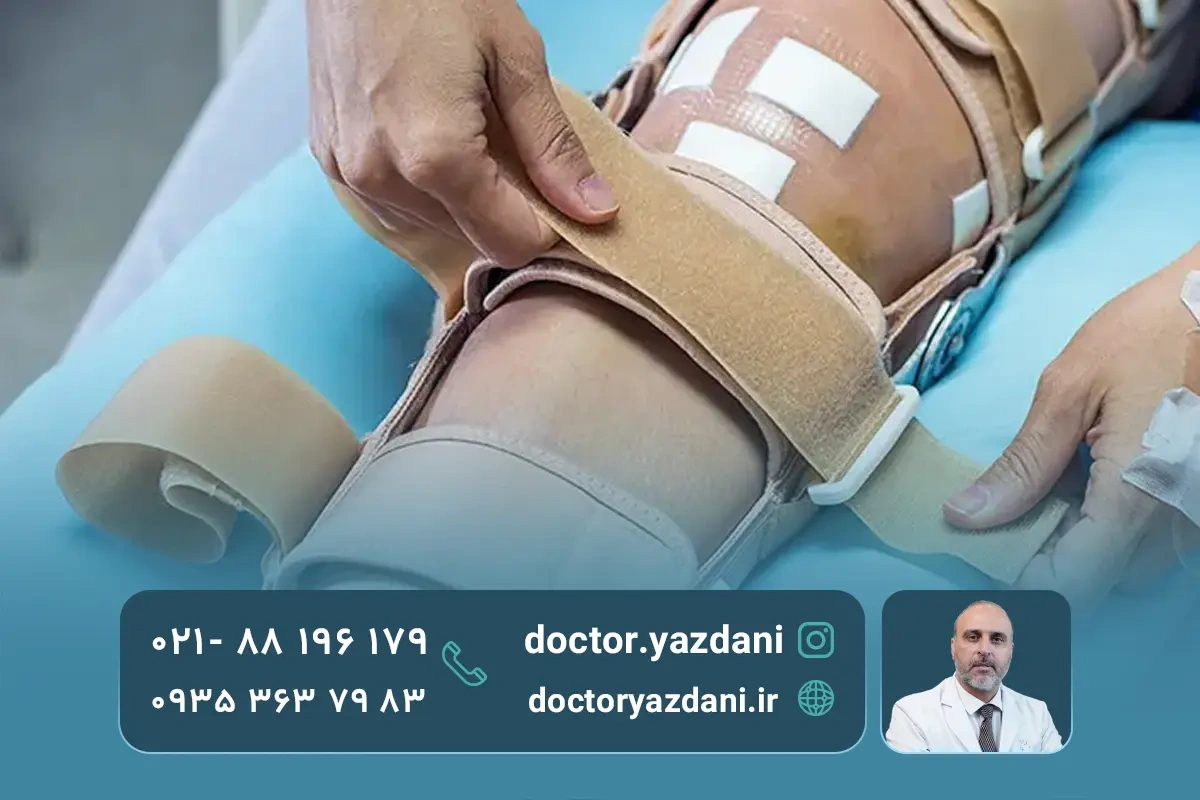 مدت زمان بهبود بعد از درمان پارگی مینیسک با سلول های بنیادی