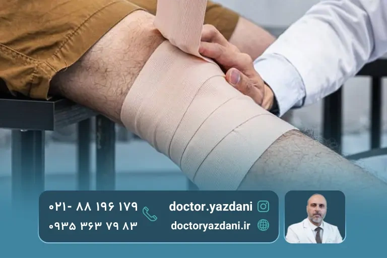 معالجه دکتر بعد از تزریق prp به زانو