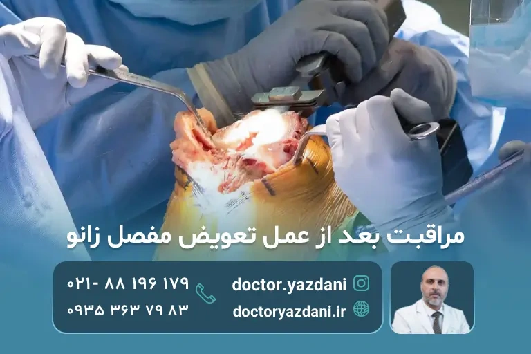مراقبت بعد از عمل تعویض مفصل زانو؛ زندگی بعد عمل زانو
