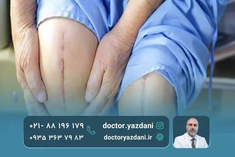 مراقبت های بعد از جراحی آرتروپلاستی