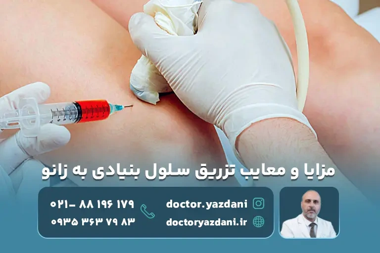 مزایا و معایب تزریق سلول بنیادی به زانو