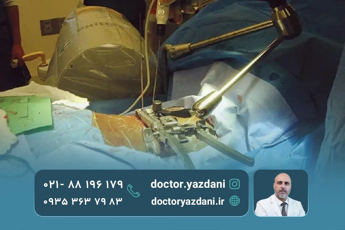 مزایا و معایب جراحی میکروسکوپی دیسک کمر