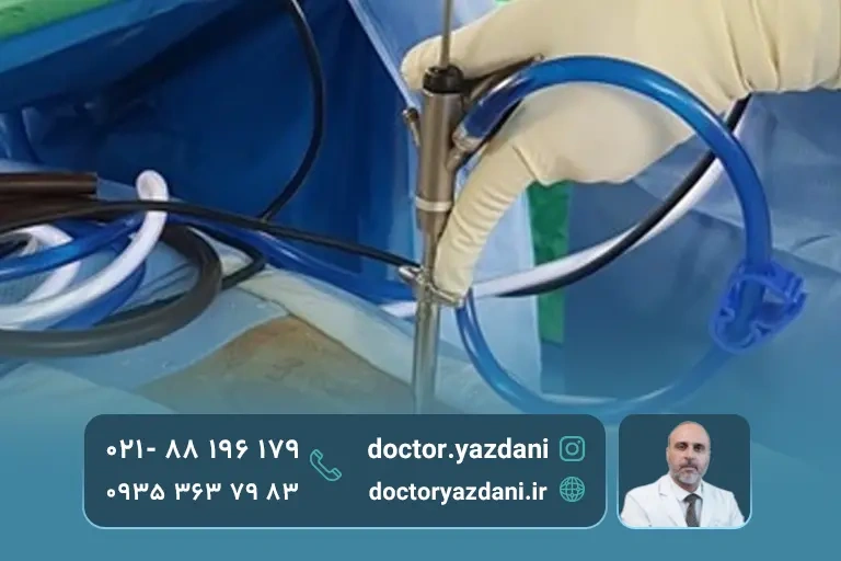 مزایا و معایب عمل آندوسکوپی