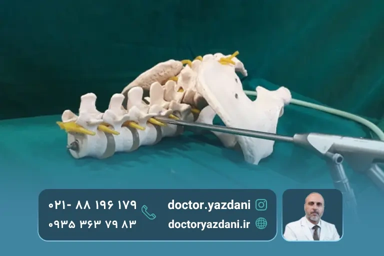 مزایای تزریق دیسکوژل