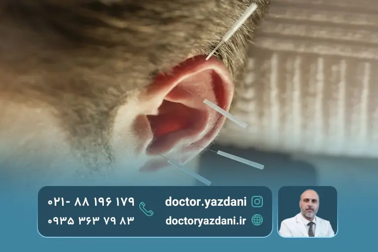 مزایای طب سوزنی گوش