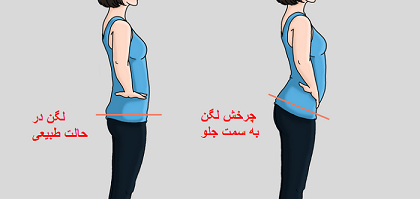چرخش قدامی لگن