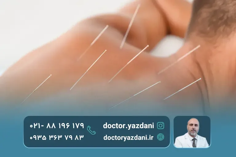 مقایسه اثر تمرین درمانی و سوزن درمانی