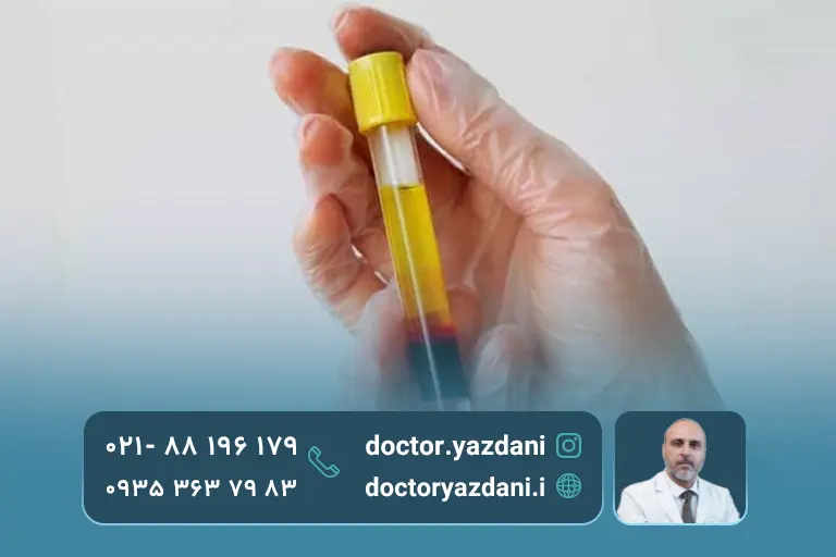 مقایسه سلول درمانی و فیزیوتراپی