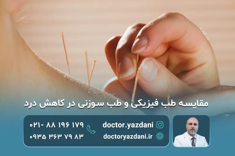 مقایسه طب سوزنی و طب فیزیکی