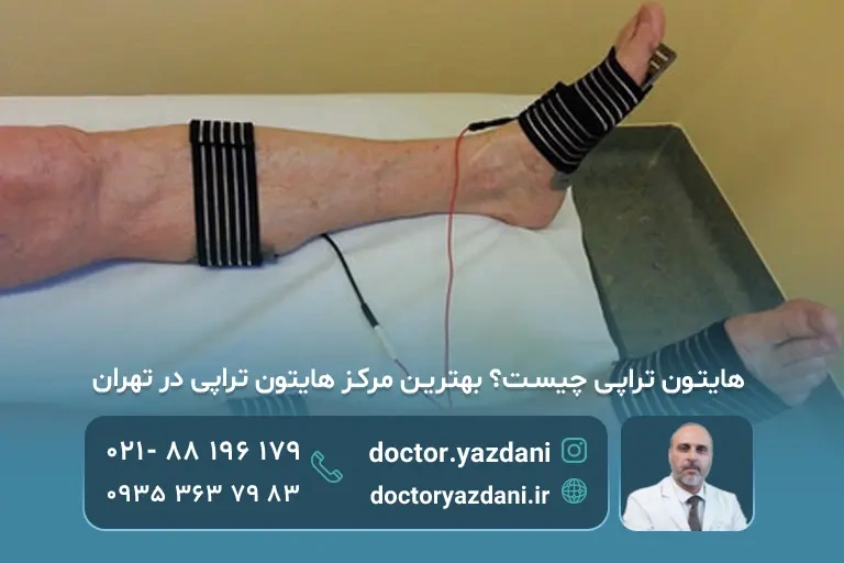 هایتون تراپی چیست؟