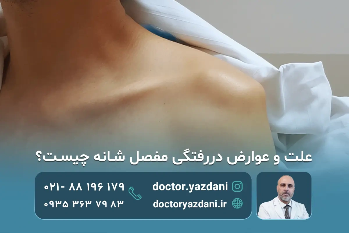 علت و عوارض دررفتگی مفصل شانه چیست ؟ بهترین روش های درمان دررفتگی شانه