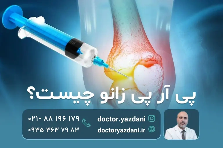 تزریق پی آر پی به زانو