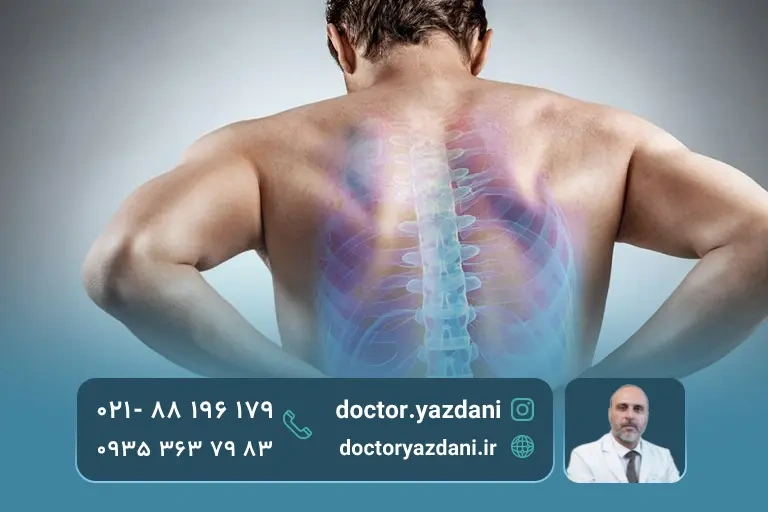 نحوه تزریق پی آر پی به کمر