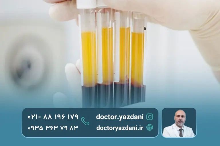 چطور عوارض prp را کمتر کنیم