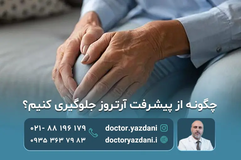 پیشگیری از آسیب بیشتر در آرتروز 