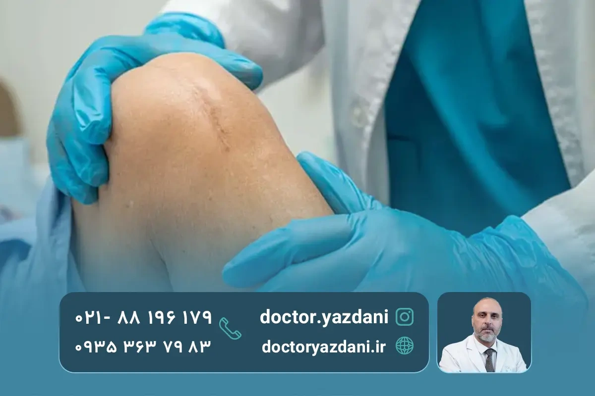 کاربرد آرتروسکوپی در درمان آسیب‌های مفصلی