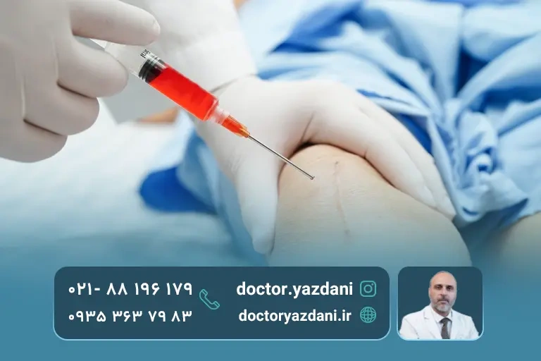 تزریق پی آرپی به زانو در تهران توسط دکتر متخصص