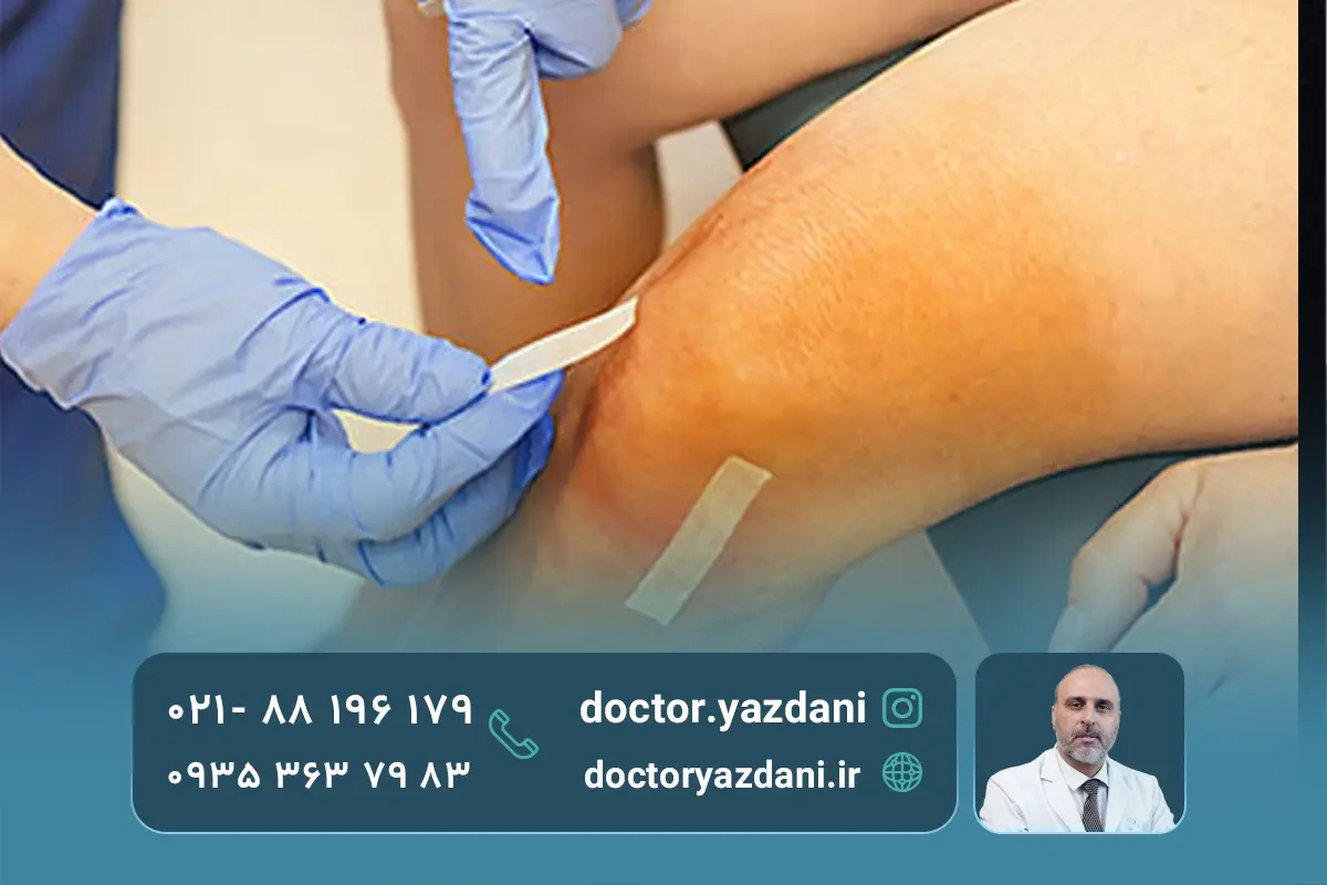 کاربرد و مزایای عمل جراحی آرتروسکوپی