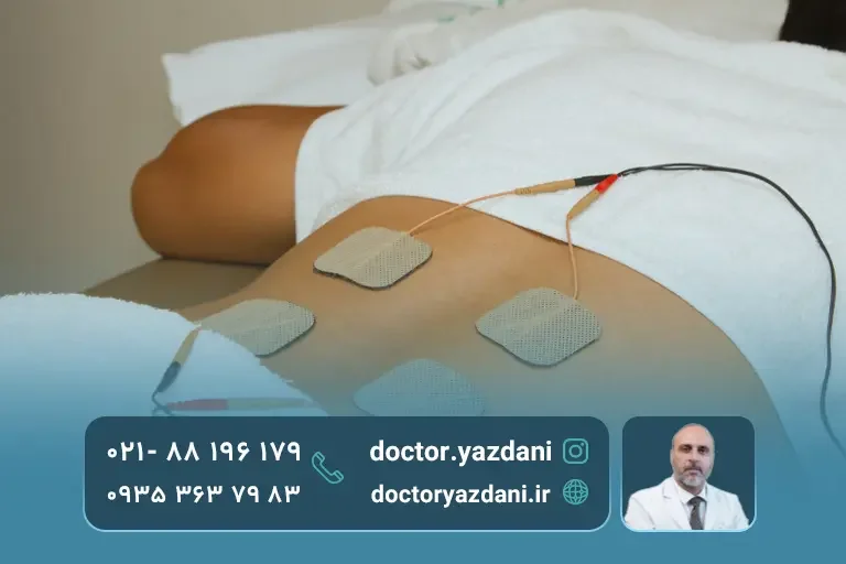 تحریک الکتریکی