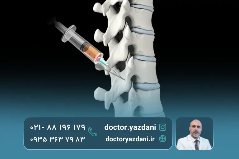 تزریق پی آر پی به کمر