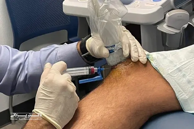 گالری تصاویر بهترین کلینیک تزریق پی آر پی در تهران + آدرس مطب و شماره تلفن 2