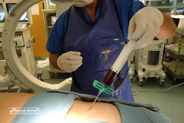 گالری تصاویر تزریق سلول های بنیادی در بهترین کلینیک در تهران 2